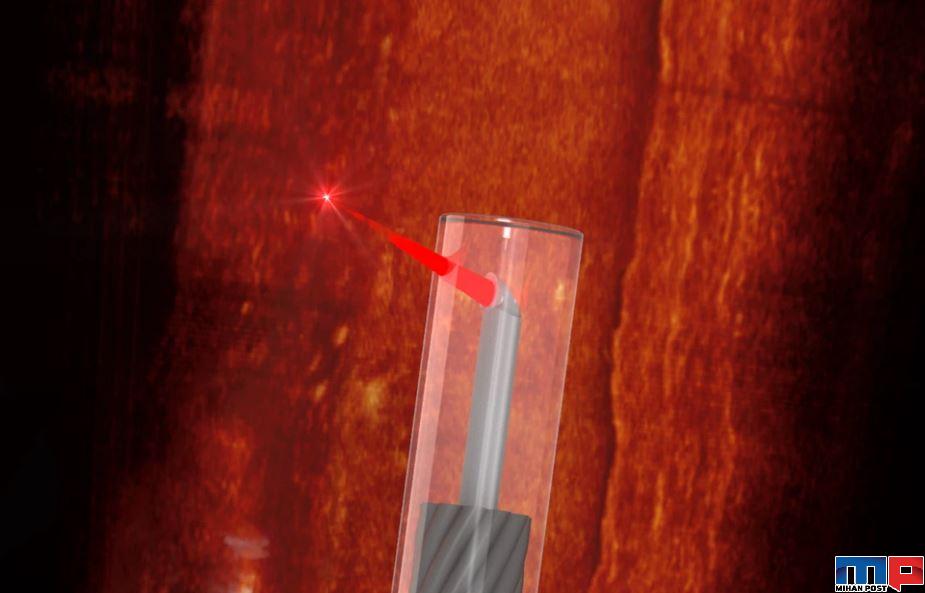 کوچکترین دستگاه تصویربرداری جهان در استرالیا ساخته شد 1 کوچکترین دستگاه تصویربرداری جهان