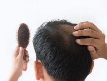 بهترین ویتامین ها برای رشد مو