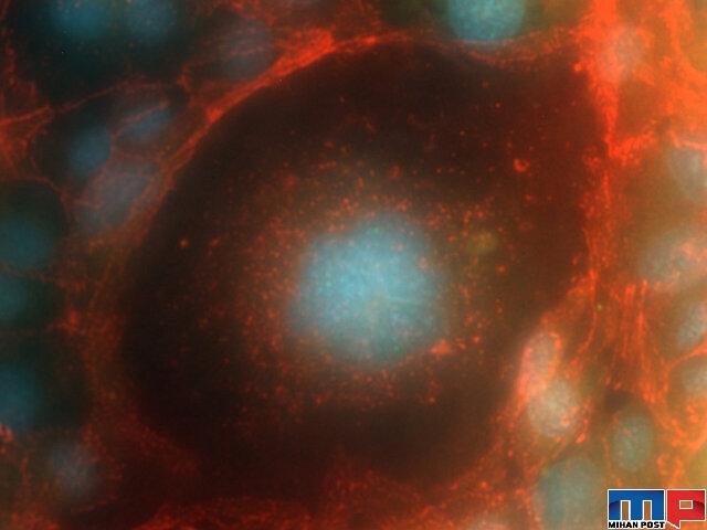 بازگشت سلول انسان از فضا و عکس آن از زیر میکروسکوپ 1 بازگشت سلول انسان از فضا