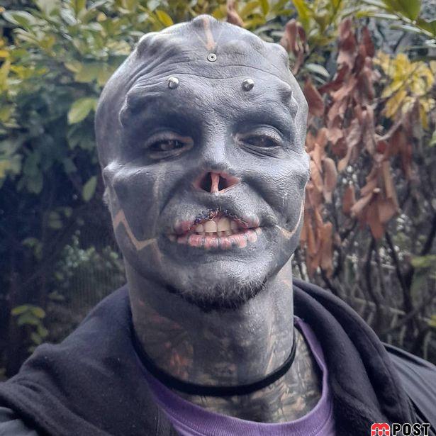 تصاویری از آنتونی لوفردو با جراحی های زیبایی عجیب و غریب 2 آنتونی لوفردو