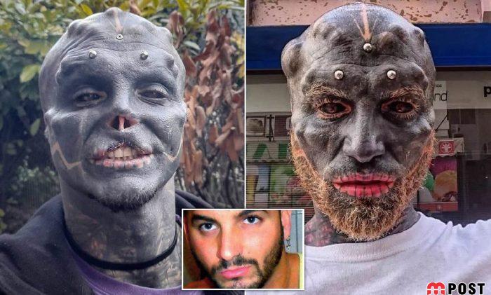 تصاویری از آنتونی لوفردو با جراحی های زیبایی عجیب و غریب 3 آنتونی لوفردو