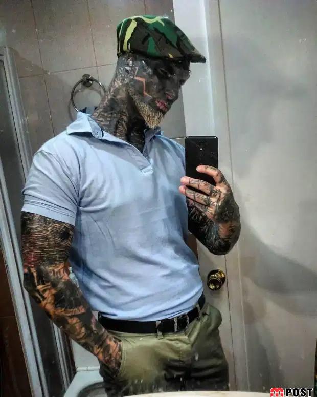 تصاویری از آنتونی لوفردو با جراحی های زیبایی عجیب و غریب 5 آنتونی لوفردو