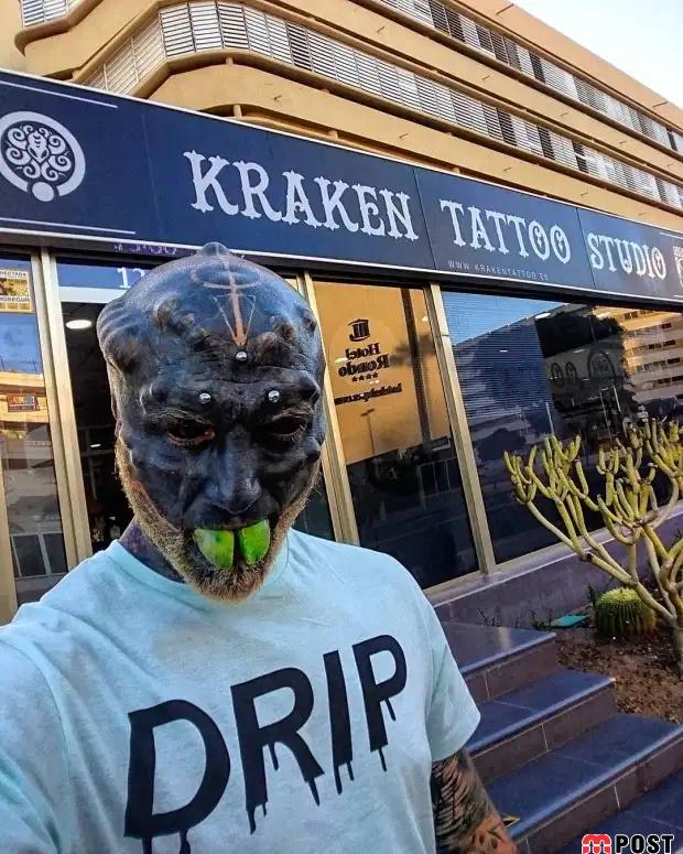 تصاویری از آنتونی لوفردو با جراحی های زیبایی عجیب و غریب 6 آنتونی لوفردو