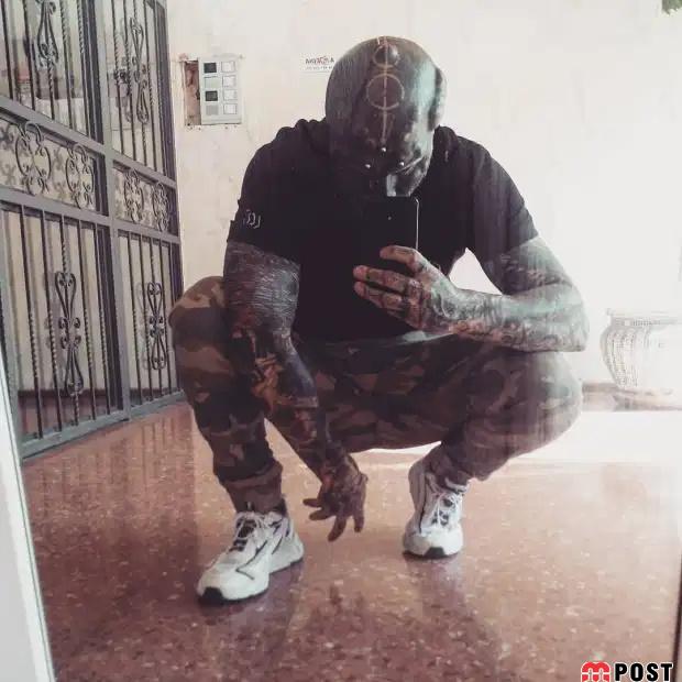 تصاویری از آنتونی لوفردو با جراحی های زیبایی عجیب و غریب 7 آنتونی لوفردو