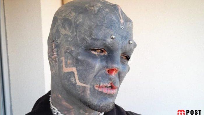 تصاویری از آنتونی لوفردو با جراحی های زیبایی عجیب و غریب 8 آنتونی لوفردو