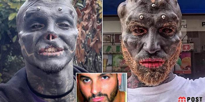 تصاویری از آنتونی لوفردو با جراحی های زیبایی عجیب و غریب 1 آنتونی لوفردو