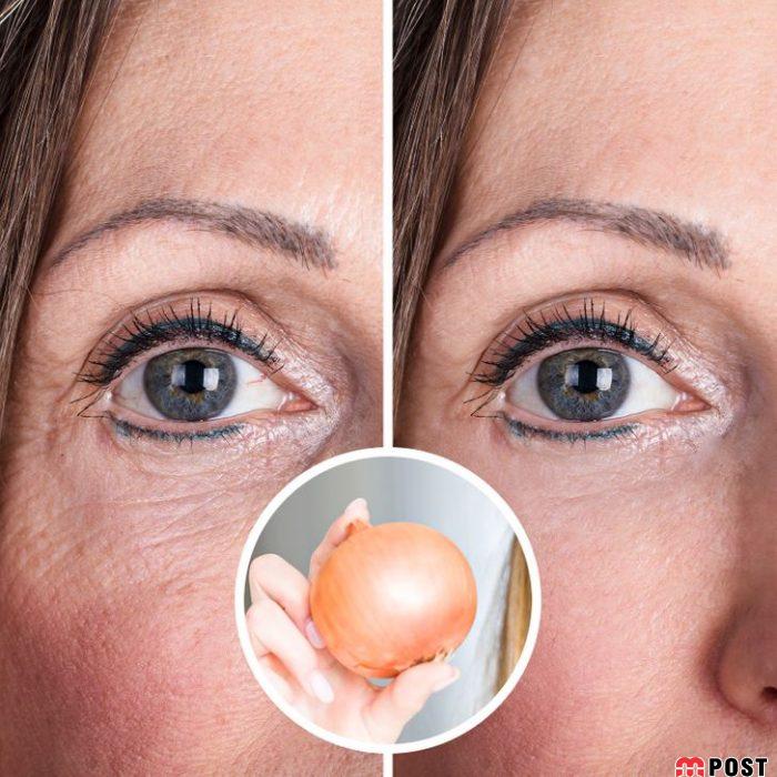 خوردن پیاز چه تغییراتی در سلامتی بدن ایجاد می کند؟ 7 خوردن پیاز