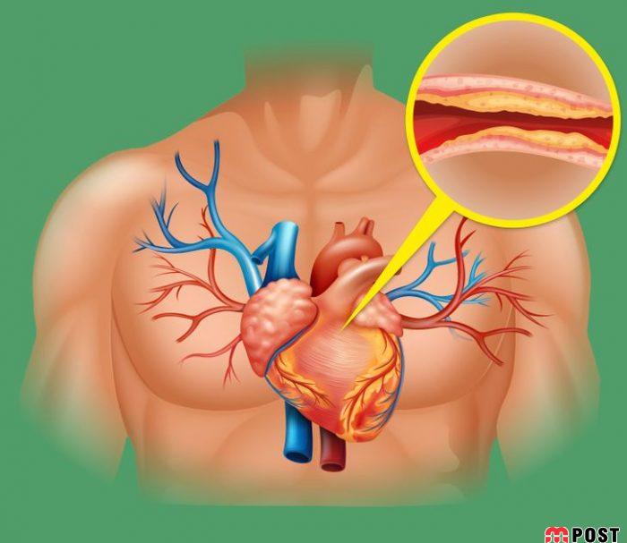 خوردن پیاز چه تغییراتی در سلامتی بدن ایجاد می کند؟ 3 خوردن پیاز
