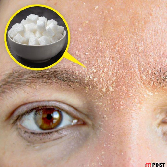 استفاده افراطی از مواد طبیعی مراقبت از پوست چه عوارضی دارد؟ 6 مواد طبیعی مراقبت از پوست