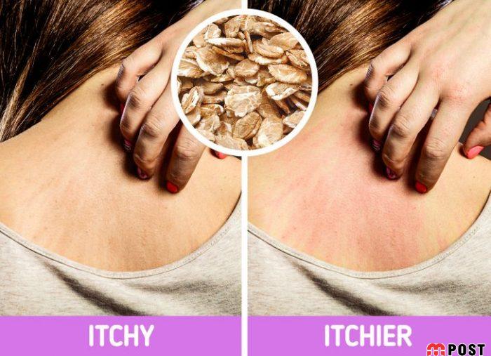 استفاده افراطی از مواد طبیعی مراقبت از پوست چه عوارضی دارد؟ 9 مواد طبیعی مراقبت از پوست