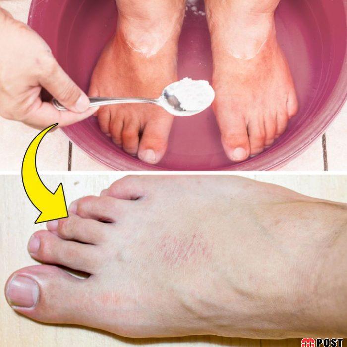 استفاده افراطی از مواد طبیعی مراقبت از پوست چه عوارضی دارد؟ 5 مواد طبیعی مراقبت از پوست