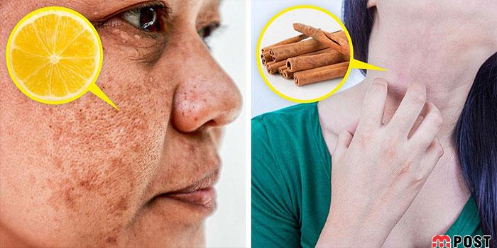 استفاده افراطی از مواد طبیعی مراقبت از پوست چه عوارضی دارد؟ 6 مواد طبیعی مراقبت از پوست