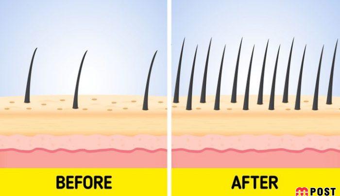 افزایش رشد مو با کشیدن ناخن های خود به هم + عکس 5 افزایش رشد مو