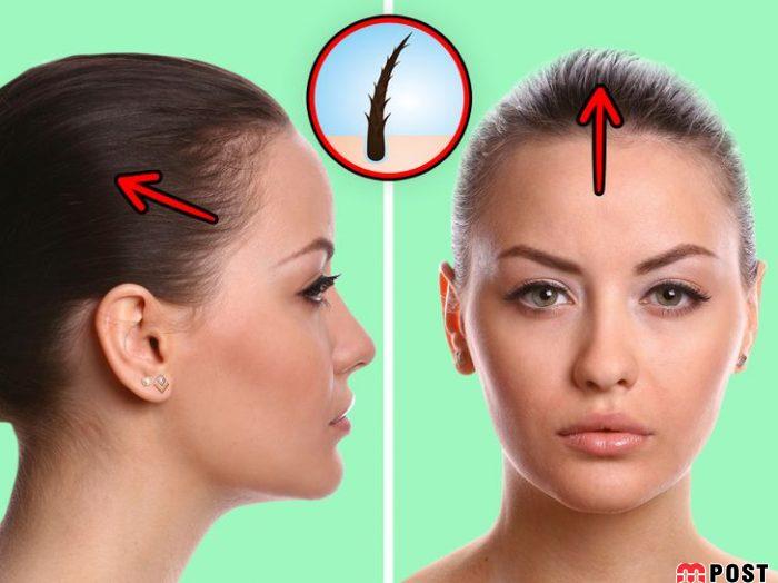 دم اسبی بستن مو چه عوارض و مضراتی به همراه دارد؟ 4 دم اسبی بستن موها