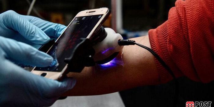 باند هوشمند جدید از زخم های مزمن پوستی جلوگیری می کند 2 باند هوشمند