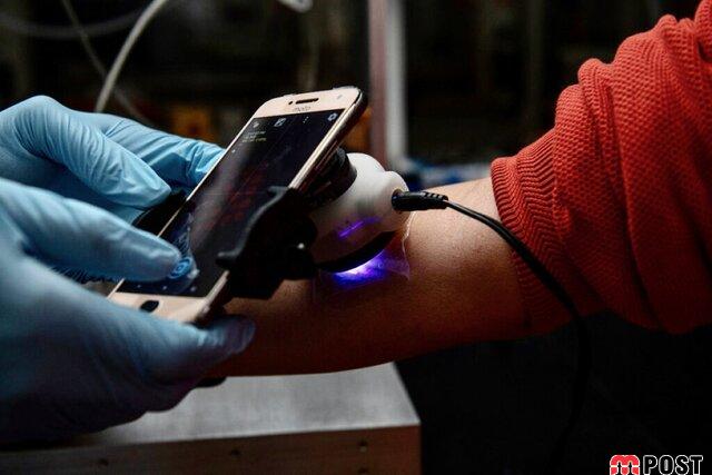 باند هوشمند جدید از زخم های مزمن پوستی جلوگیری می کند 13 باند هوشمند