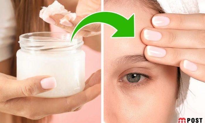 چین و چروک پیشانی را با ۵ روش ساده و موثر از بین ببرید 4 چین و چروک پیشانی