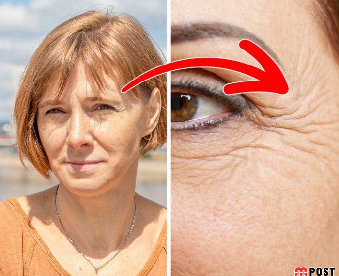 چین و چروک های پوست