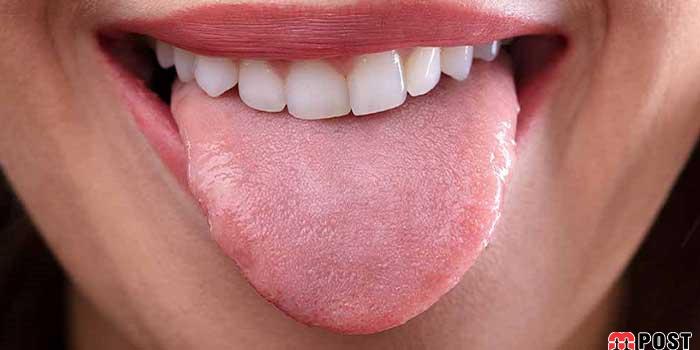 تمیز کردن زبان چه نقشی در سلامت دهان و دندان دارد؟ 1 تمیزکردن زبان