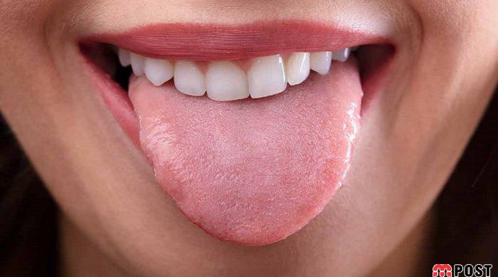 تمیز کردن زبان چه نقشی در سلامت دهان و دندان دارد؟ 2 تمیزکردن زبان