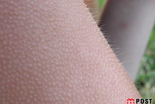 تغییرات تاریخی بدن انسان که شما را شگفت زده خواهد کرد 3 تغییرات تاریخی بدن انسان