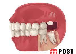 تغییرات تاریخی بدن انسان که شما را شگفت زده خواهد کرد 5 تغییرات تاریخی بدن انسان