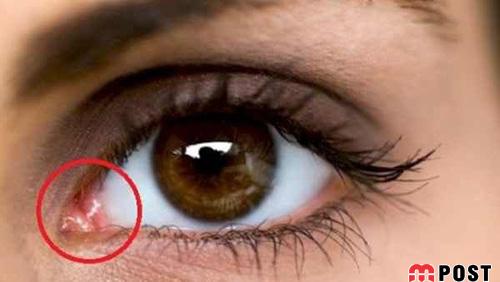 تغییرات تاریخی بدن انسان که شما را شگفت زده خواهد کرد 7 تغییرات تاریخی بدن انسان