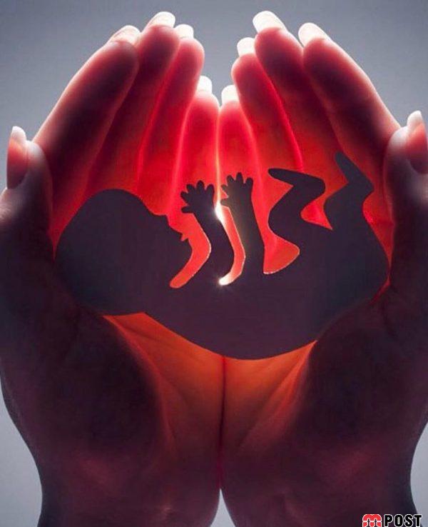 سقط مکرر و هر آنچه که باید درباره علل و راههای درمان آن بدانید 8 سقط مکرر