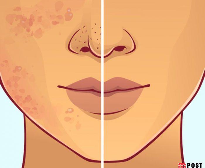 ۶ اشتباه رایج که باعث آسیب دیدگی موها هنگام خواب میشوند 3 آسیب دیدگی موها