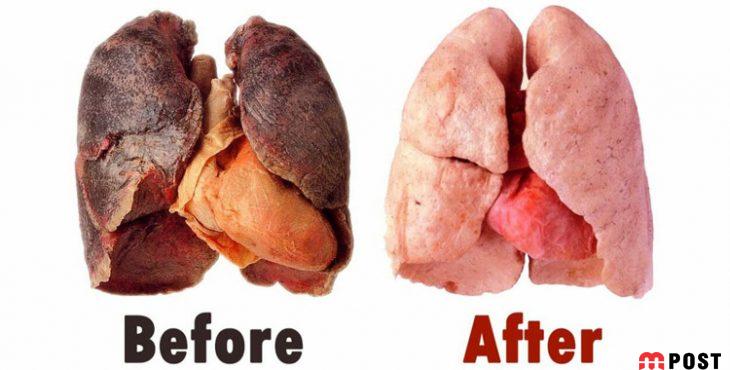 پاکسازی ریه