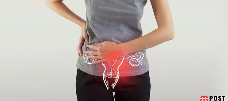 روش شناسایی و درمان کیست هموراژیک تخمدان ؟ 9 کیست هموراژیک تخمدان