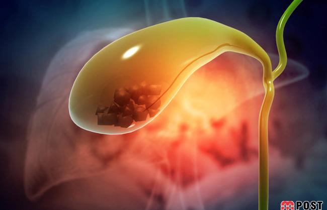 کیسه صفرا چه کار مفیدی و حیاتی در بدن انسان انجام می دهد؟ 3 کیسه صفرا