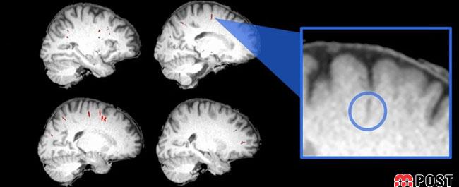 آیا اقامت در فضا ساختار مغز فضانوردان را دگرگون می کند؟ 2 تغییرات مغز فضانوردان