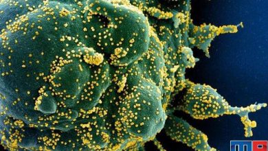 آسیب به سد خونی مغز پس از آلوده شدن به ویروس کرونا 12 brain damage