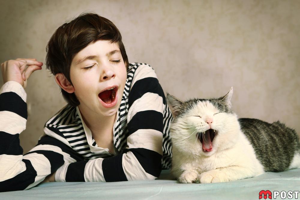 به این 4 دلیل علمی شما خمیازه Yawn بیش از حد می کشید ؟ 1 خمیازه