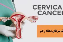 علائم سرطان دهانه رحم