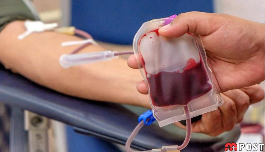 فصد خون چه فوایدی دارد و برای چه کسانی مناسب است؟ 1 فصد خون