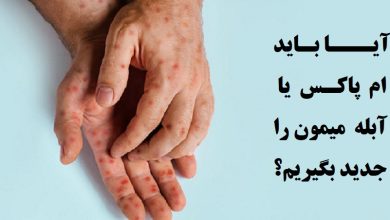 آیا باید ام پاکس یا آبله میمون را جدید بگیریم + توضیحات 7 ام پاکس یا آبله میمون