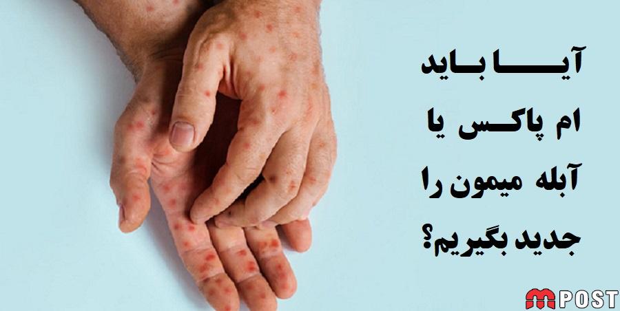 آیا باید ام پاکس یا آبله میمون را جدید بگیریم + توضیحات 1 ام پاکس یا آبله میمون