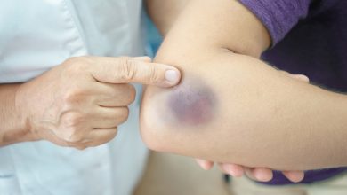 نحوه مطالبه دیه دست و دیه کبودی: راهنمای حقوقی برای آسیبهای جسمی 22 d015e579 a59f 429a 824e 5e4b7fc7c694