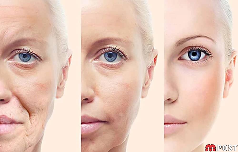 جوانسازی پوست صورت