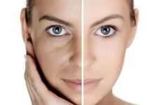 آشنایی با راهکارهای علمی جوانسازی پوست صورت ؟ 3 جوانسازی پوست صورت