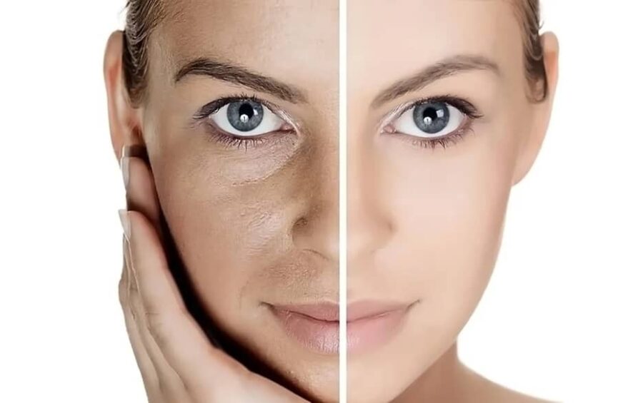 جوانسازی پوست صورت