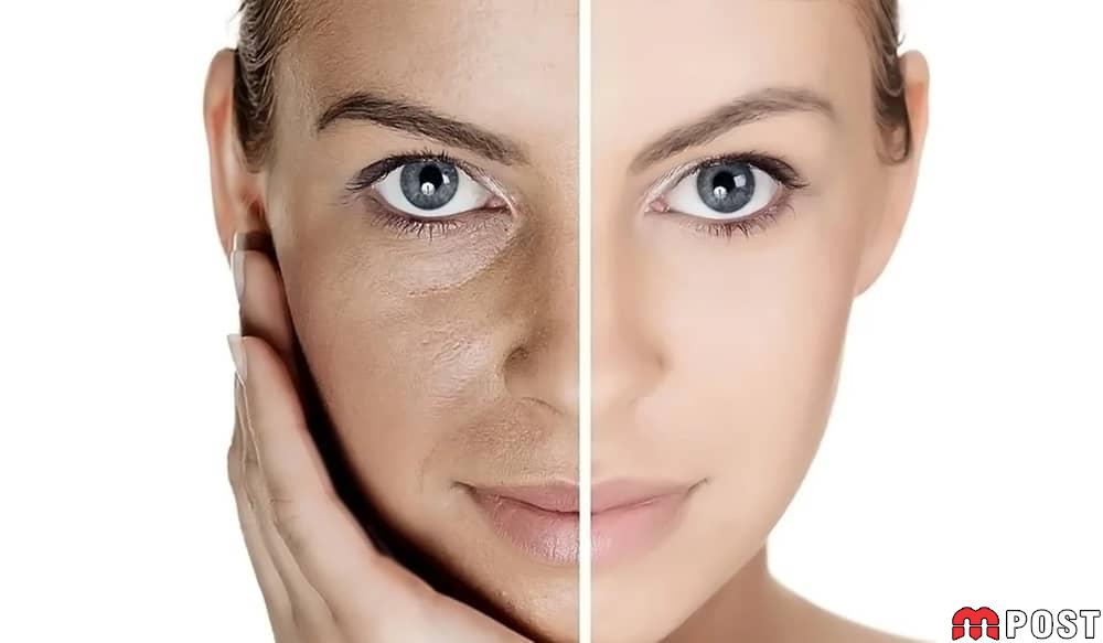 جوانسازی پوست صورت
