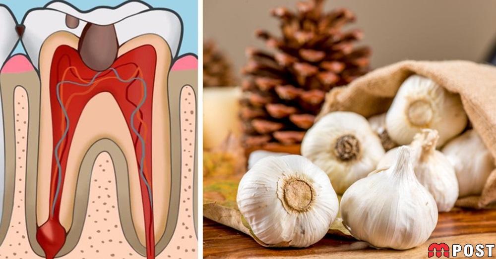 درمان دندان درد 