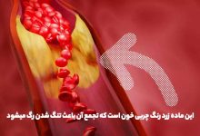 چربی خون