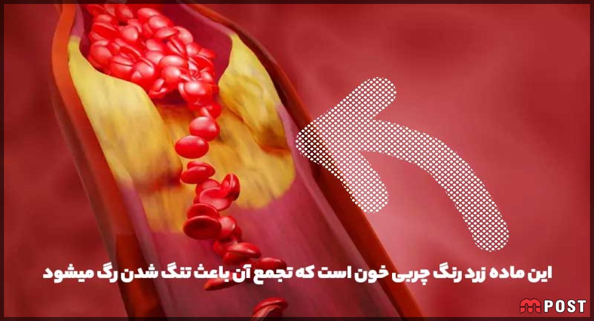 چربی خون