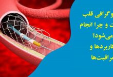 آنژیوگرافی قلب