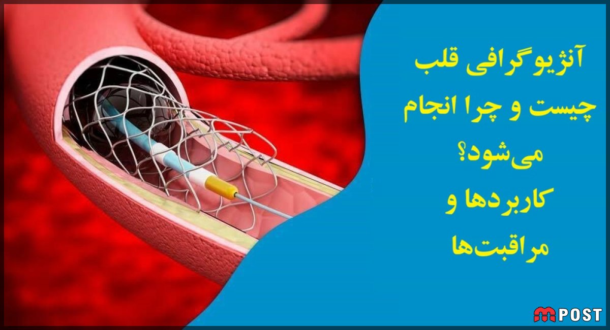 آنژیوگرافی قلب